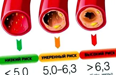 крапельниця крапельниця