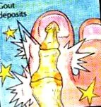footcare подагра
