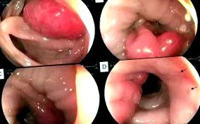 слизової