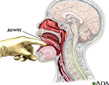 mérgező Medical Encyclopedia