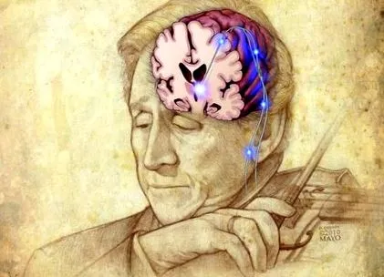 мозку