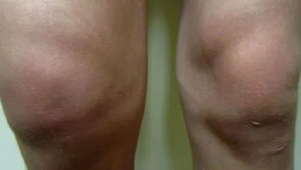 teachmesurgery