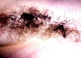 dermnet