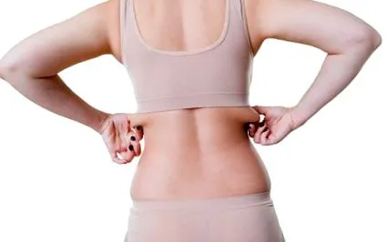 coolsculpting back
