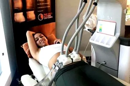sculpsure коли-небудь