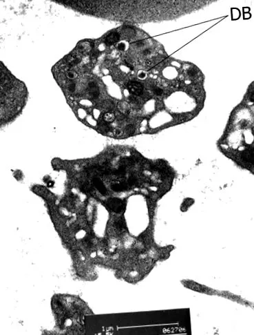 krónikus gastroduodenitis
