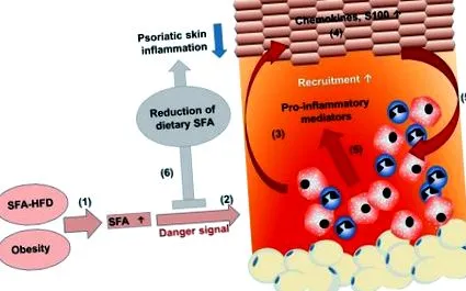 psoriasis elhízás
