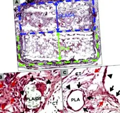 vitro