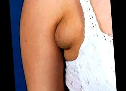 причини