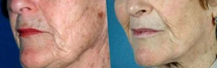 rejuvenis rejuvenis