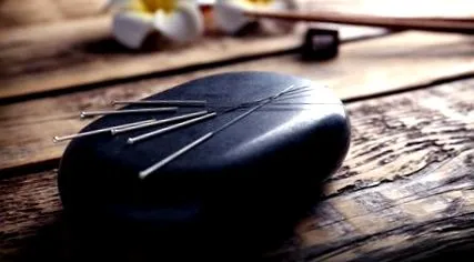 маємо увазі акупунктура