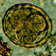 lumbricoides ascaris