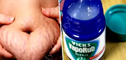 kell használni