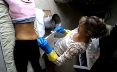 компрес