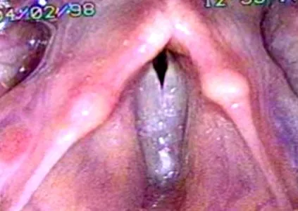 anabolikus