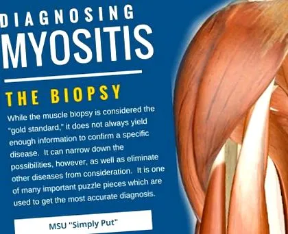 myositis