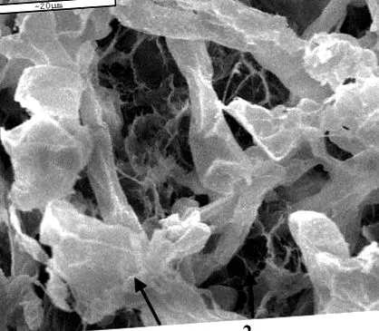 rhizopus oryzae