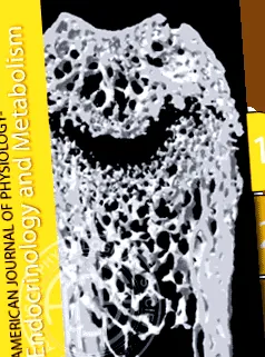 ösztrogénreceptor-modulátor