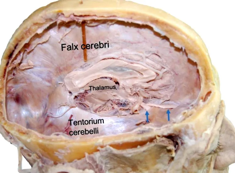 cerebelli áttekintés