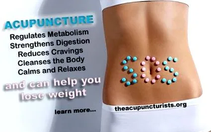 acupunctura