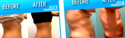 beneficii