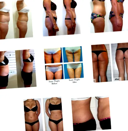 my-lipo light