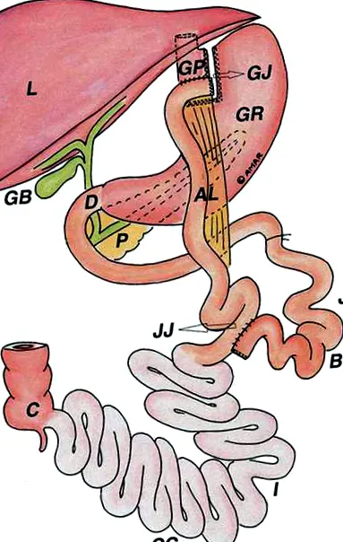 endoscopia