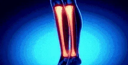 törései