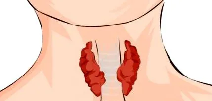 thyromate