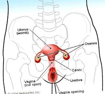 cancer ovarian