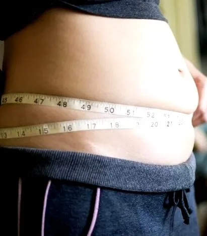 abdominală