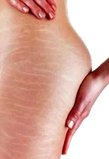 colagen elastină