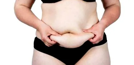 coolsculpting