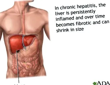 medlineplus