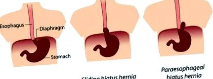 chirurgical