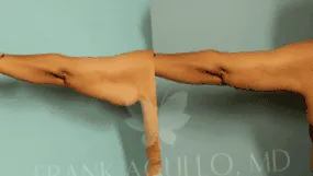 след ръцете