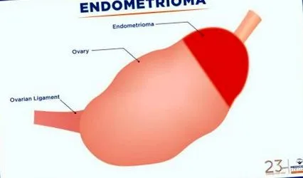 medicover