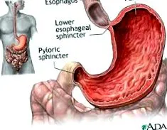 îndepărta