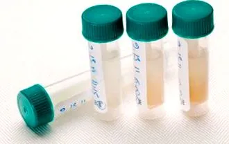 pericolele