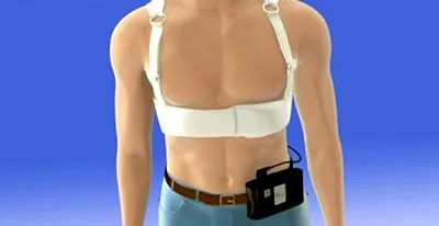 cardioverter