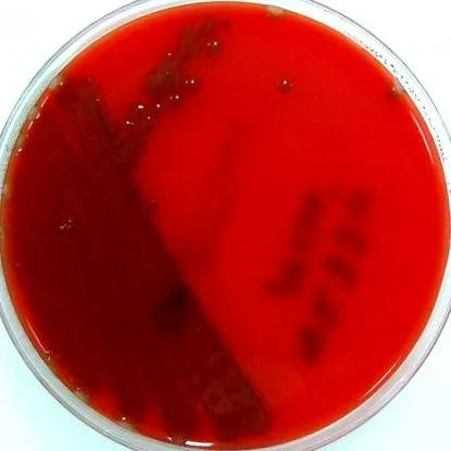 Diagnosticul tratamentul