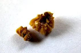 камъни