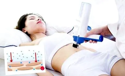 aplicator