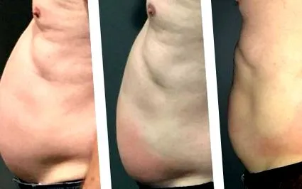 slimming