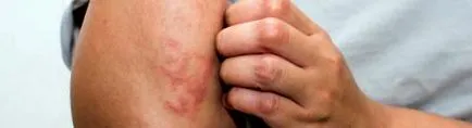 диета съвети