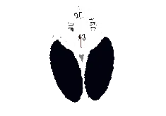 диета