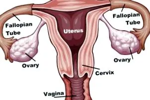 ovariene