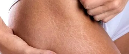 prevenirea
