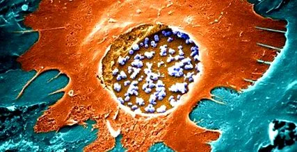 chlamydia