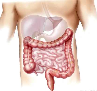intestinul